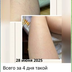 8 фото,отзыв